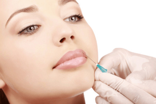 A woman receiving dermal fillers from Natural Face Aesthetics in Malmesbury, Wiltshire.