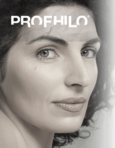 A woman receiving Profhilo from Natural Face Aesthetics in Malmesbury, Wiltshire.
